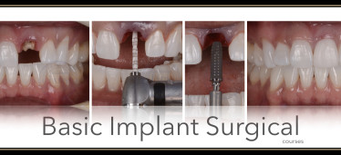 Basic 101 implant course